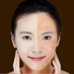 Appareil Anti-Imperfections Femme montrant une peau nette et éclatante avant-après utilisation avec réduction des boutons et imperfections