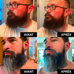 Lisseur à barbe homme électrique anti frisottis – détail produit