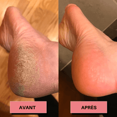 OneScale Rape à pied électrique USB rechargeable rose – mise en situation