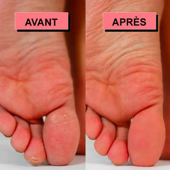 OneScale Rape à pied électrique USB rechargeable rose – détail produit